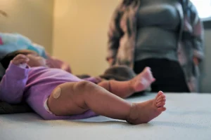 பூனை கீறியதால் தற்காலிகமாக பார்வையை இழந்த நபர்