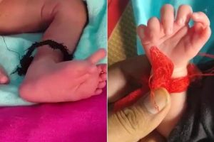 XL  புல்லி” நாய் இனத்தை தடை செய்ய இங்கிலாந்து தீர்மானம்!