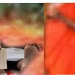 அவுஸ்திரேலியாவிற்கு சென்ற இலங்கை பெண்னொருவருக்கு காத்திருந்த அதிர்ச்சி! அறுவை சிகிச்சை மூலம் அகற்றப்பட்ட  கை